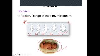 NEONATAL EXAMINATION [upl. by Kannan953]