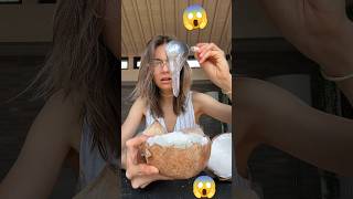 Coconut abnormal sperm 😱 👀 💫 shorts ytshorts youtubeshorts [upl. by Annenn]