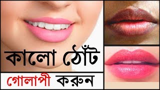 কালো ঠোঁট গোলাপী করার উপায় জেনে নিন।How to get Pink lips by using Clovate ointment [upl. by Ariaz]