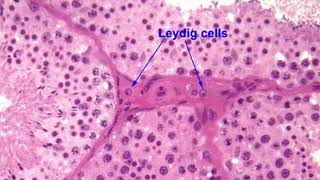 MAXIMIZE YOUR TESTOSTERONE  Leydig Cells [upl. by Glimp]