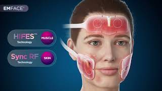 Emface Mechanism of Action [upl. by Tuttle]