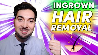 How To Get Rid Of Ingrown Hair Removal and Treatment [upl. by Briant]