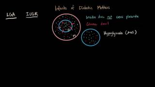 Infants of Diabetic Mothers [upl. by Yentirb851]