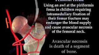 Avascular Necrosis Blood Supply Femoral Head Everything You Need To Know  Dr Nabil Ebraheim [upl. by Gerianna]