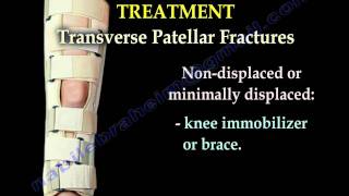 Patellar Fractures  Everything You Need To Know  Dr Nabil Ebraheim [upl. by Enoryt]