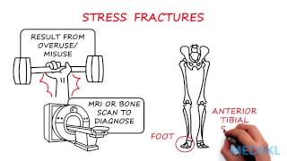 Orthopedics  Bone or Joint Injury By Shalini Ramasunder MD [upl. by Baggs823]