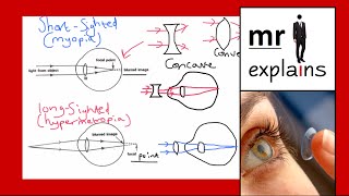 mr i explains Accommodation Shortsightedness myopia and Longsightedness hypermetropia [upl. by Halli]