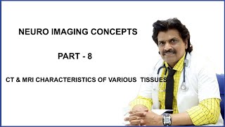 NEURO IMAGING CONCEPTS  PART 8 CT amp MRI CHARACTERISTICS OF VARIOUS TISSUES [upl. by Caswell]