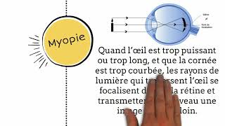 Myopie symptômes et traitement [upl. by Tahpos]