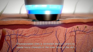 APOLLO DUET  Electroporation amp Iontophoresis [upl. by Nnylassej]