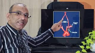 Subclavian steal syndrome  English  Patient teaching programme [upl. by Regdor]