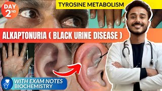 tyrosine metabolism biochemistry  alkaptonuria biochemistry  black urine disease biochemistry [upl. by Asselim]