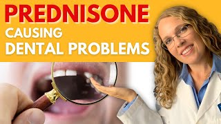 Prednisone Causing Dental Problems [upl. by Nuahsad]