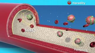 VAP Lipid Panel Animation [upl. by Truscott]