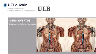 Pathologie médicale et chirurgicale  « Situs inversus »  par Darius Ahmadian [upl. by Adena]