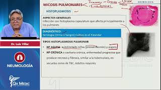 2024 NEUMOLOGÍA Micosis pulmonares Histoplasmosis [upl. by Slotnick]