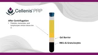 Cellenis PRP for patients How it works [upl. by Vanda]