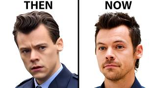 Harry Styles Hair Transplant  Plastic Surgery Analysis [upl. by Rats]