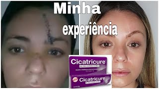 CICATRICURE FUNCIONA RESPONDENDO PERGUNTAS SOBRE MINHA EXPERIÊNCIAcicatriz cicatricure [upl. by Heyes]