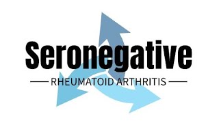 Seronegative Rheumatoid Arthritis rheumatology rheumatoid seronegative [upl. by Antoinette]