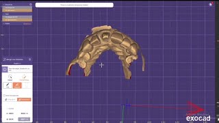 Exocad Tricks  1  How to detect finish line perfectly in Exocad [upl. by Yttocs]