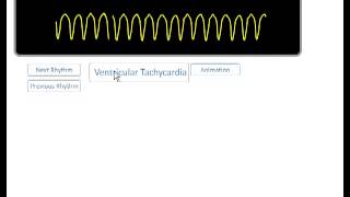 ACLS ECG Rhythm Review  YouTube [upl. by Atsillac]