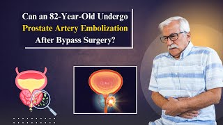 Prostate Artery Embolization in Hyderabad  NonSurgical Treatment  Prostate Surgery nonsurgical [upl. by Leontina588]