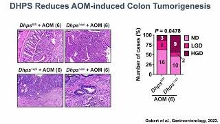 Hypusine and electrophilic stress in colitis and colon carcinogenesis [upl. by Ynottirb645]