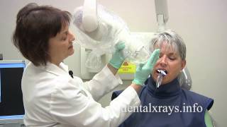 How to take dental xrays with bisecting angle positioning [upl. by Netsreik]