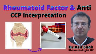 Rheumatoid Factor amp Anti  CCP interpretation  English Version [upl. by Hopper]