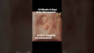 4D Ultrasound jerbearimaging 10weeks baby pregnant 4dultrasound hdlive sono [upl. by Yaned]