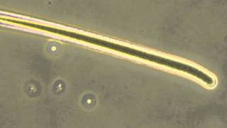 Algae microscopic exam Oscillatoria Pediastrum Anacystis Euglena 400x Phase Contrast [upl. by Juta88]