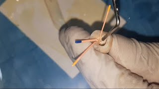 introduction to Endodontics obturation practical عربي [upl. by Alice]