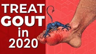 How to treat URIC ACID and GOUT Natural Foods to EAT and AVOID 2020 [upl. by Imerej]