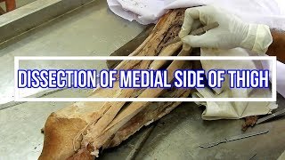 Dissection of Medial Side of Thigh [upl. by Patin]