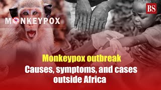 Monkeypox outbreak Causes symptoms and cases outside Africa [upl. by Eyak870]