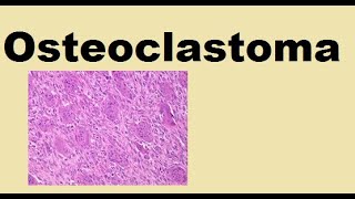 Osteoclastoma  Giant cell tumor [upl. by Annasoh]