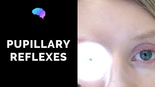 Pupillary Reflexes  OSCE Guide Clip  UKMLA  CPSA [upl. by Amitak]