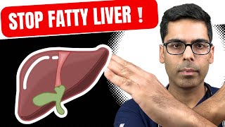 These are THE BEST Natural Remedies for Fatty Liver Harvard Trained Doctor Explains [upl. by Ycaj]