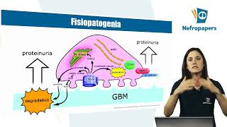 Aula Glomerulopatia Membranosa do Curso da Prova de Título Nefropapers Por Duda Vilanova [upl. by Leake]