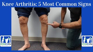 Heres Why Your Knee Hurts  Knee Pain Problems amp Types by Location [upl. by Illac]