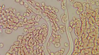 Heartworm in dogs CIAB wwwciabes [upl. by Ak]