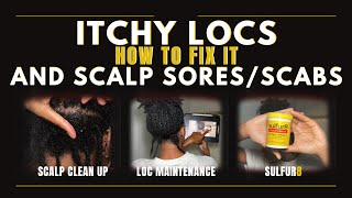 How to Fix Itchy Locs and Scalp SoresScabs [upl. by Neral]