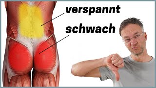 Die häufigste Ursache für Rückenschmerzen Anatomie erklärt [upl. by Fondea]