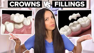 Dental Crowns Vs Dental Fillings Whats the Difference [upl. by Nurat]