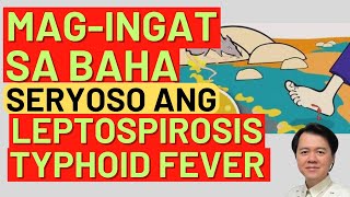 Magingat sa Baha Seryoso ang Leptospirosis Typhoid Fever By Doc Willie Ong [upl. by Eremaj]