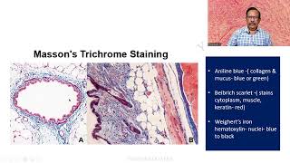 MD DNB Practical CONNECTIVE TISSUE STAINS Massons Trichrome Univ Exam [upl. by Bronder]