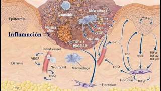 Inflamación Aguda  Fisiopatología [upl. by Aynnek]