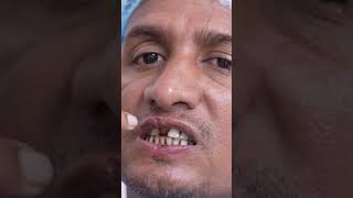 Lip Revision Surgery  Before amp After Results  Dr Sunil Richardson [upl. by Wack]