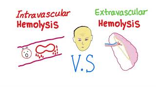 Intravascular Vs Extravascular Hemolytic Anemia Whats The ACTUAL Difference [upl. by Atilal]